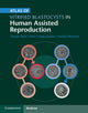 Book cover of: Atlas of Vitrified Blastocysts in Human Assisted Reproduction. By: Thomas Ebner