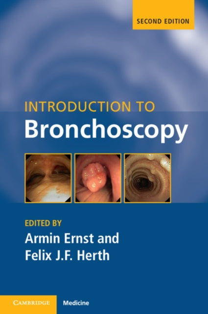 Book cover of: Introduction to Bronchoscopy. By: Armin Ernst