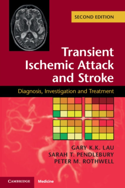 Book cover of: Transient Ischemic Attack and Stroke. By: Gary K. K. Lau