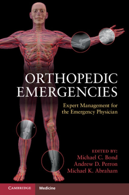 Book cover of: Orthopedic Emergencies. By: Michael C. Bond