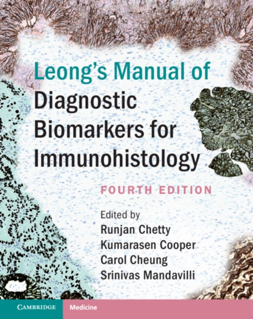 Book cover of: Leong's Manual of Diagnostic Biomarkers for Immunohistology. By: Runjan Chetty