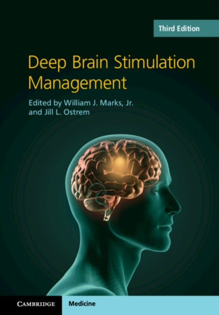 Book cover of: Deep Brain Stimulation Management. By: Marks, William J., Jr.