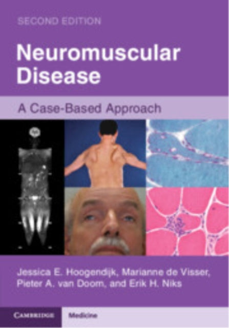 Book cover of: Neuromuscular Disease. By: Jessica E. Hoogendijk