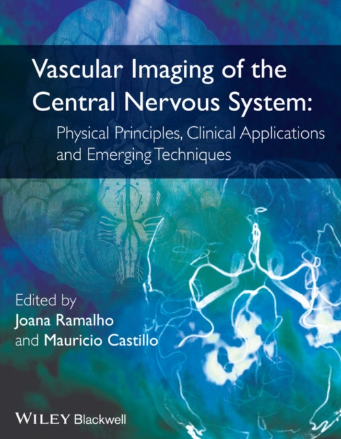 Book cover of: Vascular Imaging of the Central Nervous System