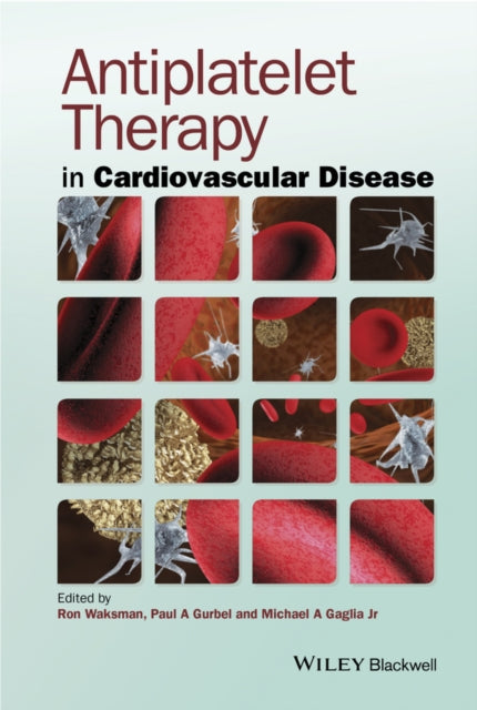 Book cover of: Antiplatelet Therapy in Cardiovascular Disease