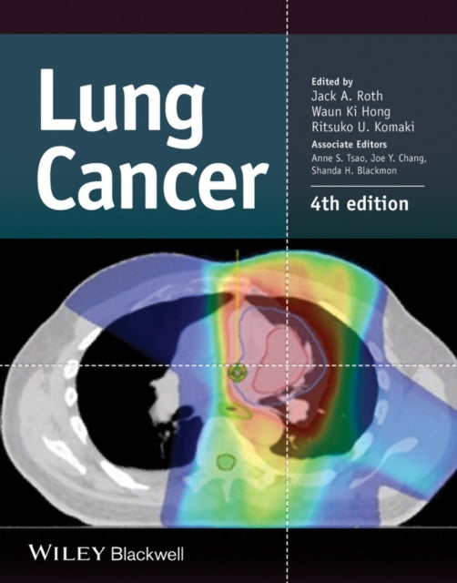Book cover of: Lung Cancer