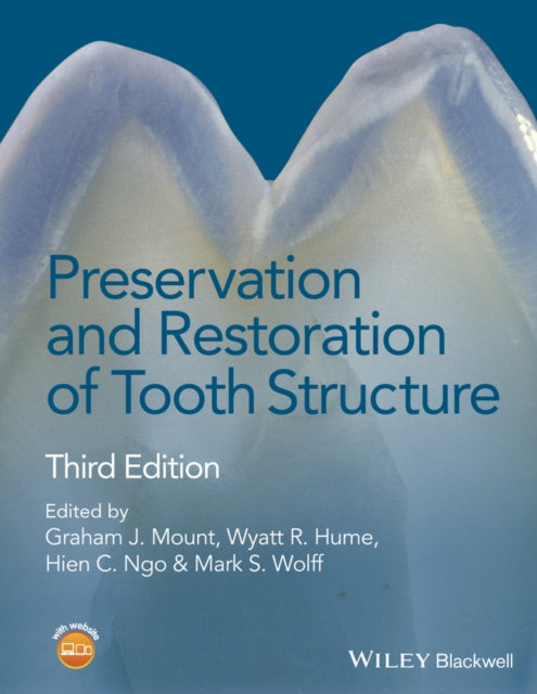 Book cover of: Preservation and Restoration of Tooth Structure. By: Graham J. Mount