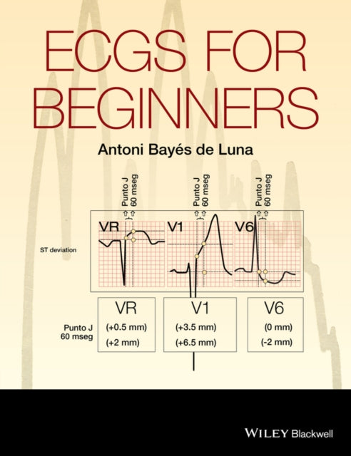 Book cover of: ECGs for Beginners. By: Antoni Bayés de Luna