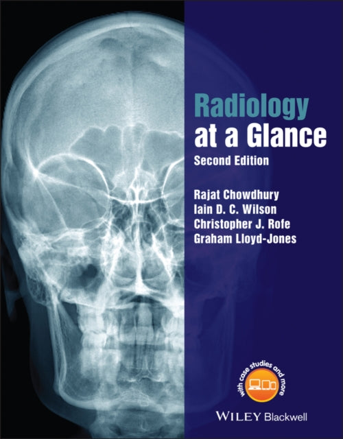 Book cover of: Radiology at a Glance. By: Rajat Chowdhury