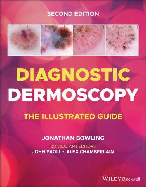 Book cover of: Diagnostic Dermoscopy. By: Jonathan Bowling