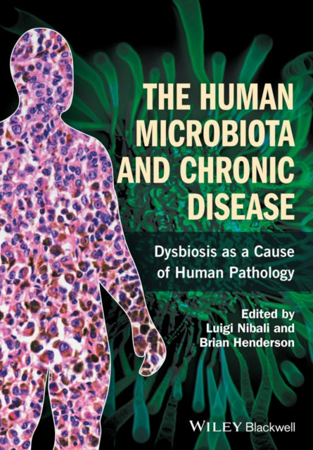 Book cover of: Human Microbiota and Chronic Disease. By: Luigi Nibali