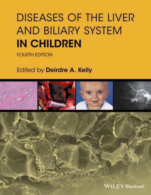 Book cover of: Diseases of the Liver and Biliary System in Children. By: Deirdre A. Kelly