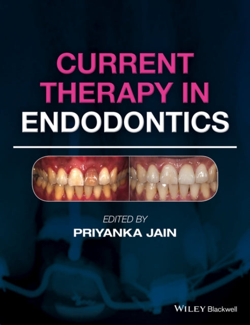 Book cover of: Current Therapy in Endodontics. By: Priyanka Jain