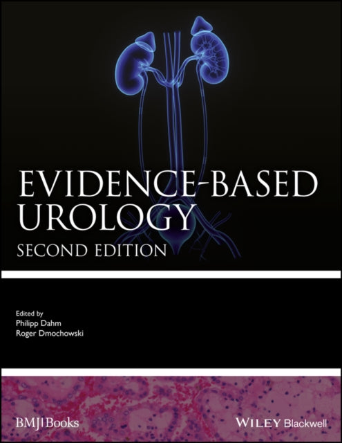 Book cover of: Evidence-based Urology