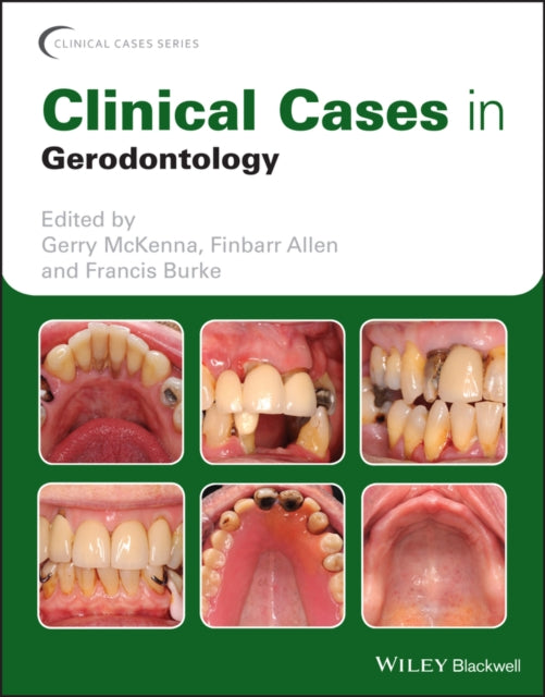 Book cover of: Clinical Cases in Gerodontology. By: Gerry McKenna