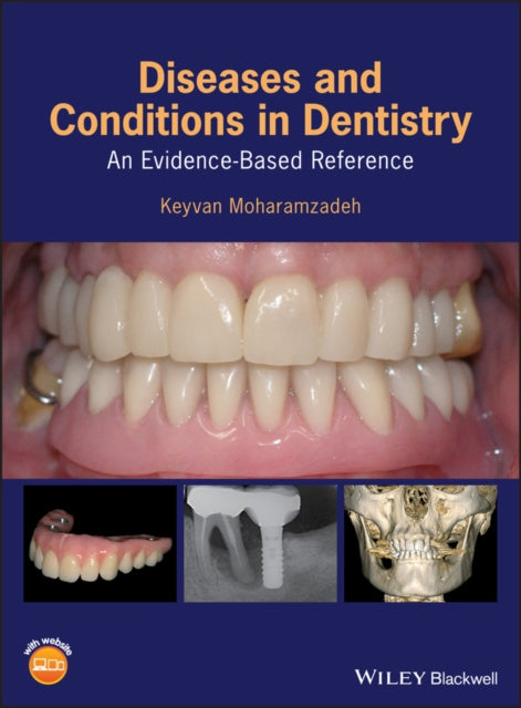 Book cover of: Diseases and Conditions in Dentistry. By: Keyvan Moharamzadeh
