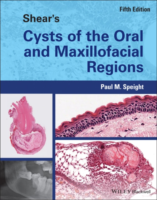 Book cover of: Shear's Cysts of the Oral and Maxillofacial Regions. By: Paul Speight
