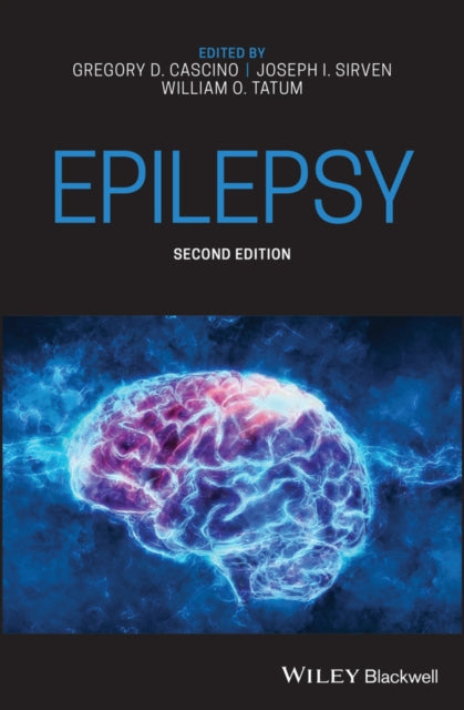 Book cover of: Epilepsy. By: Gregory D. Cascino