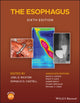 Book cover of: Esophagus. By: Joel E. Richter
