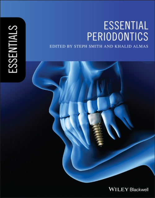 Book cover of: Essential Periodontics. By: Steph Smith