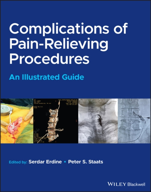 Book cover of: Complications of Pain-Relieving Procedures. By: Serdar Erdine