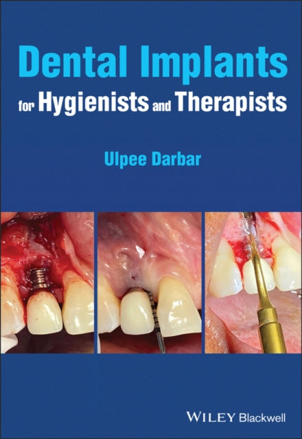 Book cover of: Dental Implants for Hygienists and Therapists. By: Ulpee R. Darbar