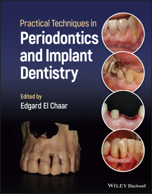 Book cover of: Practical Techniques in Periodontics and Implant Dentistry. By: Edgard El Chaar