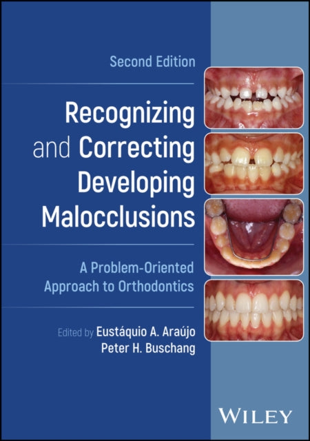 Recognizing and Correcting Developing Malocclusions