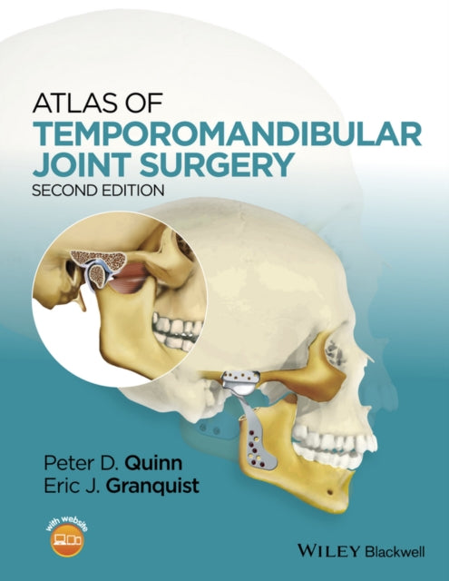 Book cover of: Atlas of Temporomandibular Joint Surgery. By: Peter D. Quinn