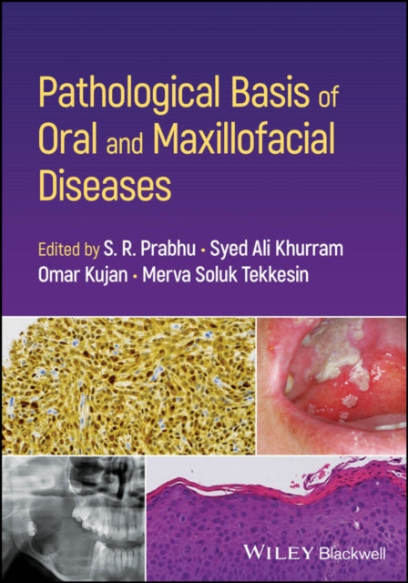 Book cover of: Pathological Basis of Oral and Maxillofacial Diseases. By: S. R. Prabhu