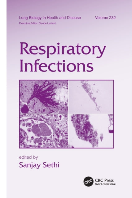 Book cover of: Respiratory Infections. By: Sanjay Sethi