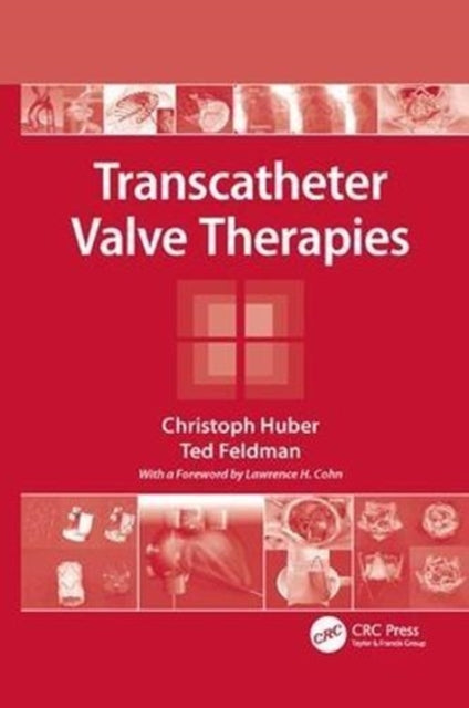 Book cover of: Transcatheter Valve Therapies. By: Christoph Huber