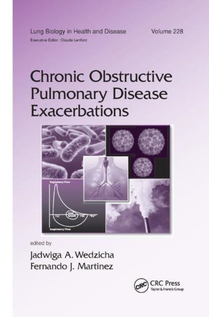 Book cover of: Chronic Obstructive Pulmonary Disease Exacerbations. By: Jadwiga A. Wedzicha