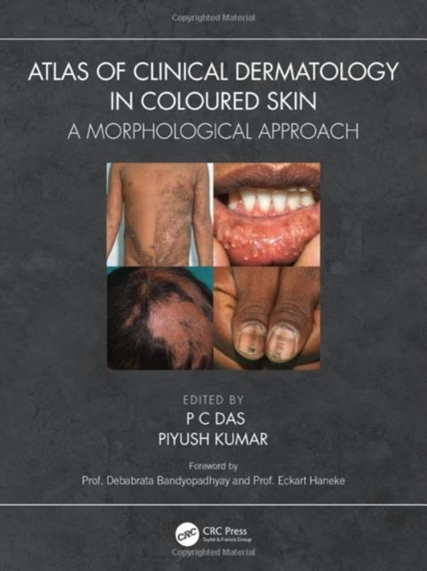 Book cover of: Atlas of Clinical Dermatology in Coloured Skin. By: P. C. Das