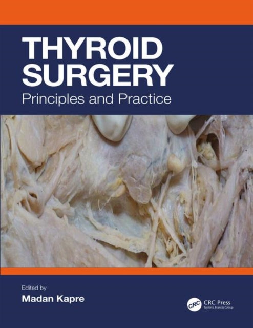 Book cover of: Thyroid Surgery. By: Madan Laxman Kapre