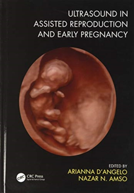 Book cover of: Ultrasound in Assisted Reproduction and Early Pregnancy. By: Arianna D'Angelo