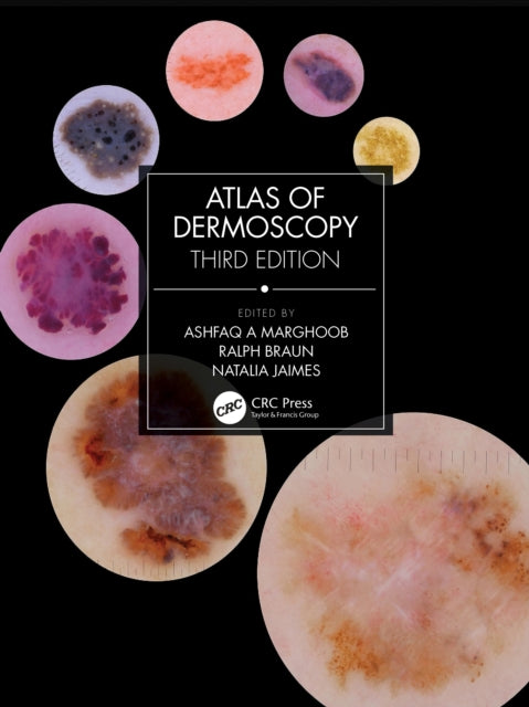 Book cover of: Atlas of Dermoscopy. By: Ashfaq A. Marghoob
