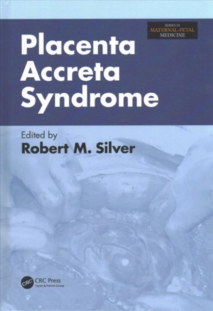 Book cover of: Placenta Accreta Syndrome. By: Robert Silver