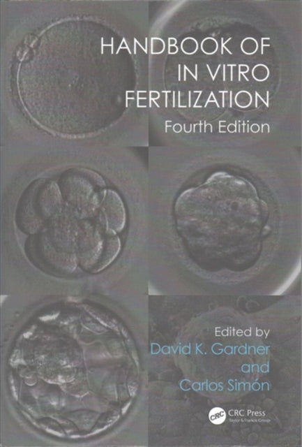 Handbook of In Vitro Fertilization