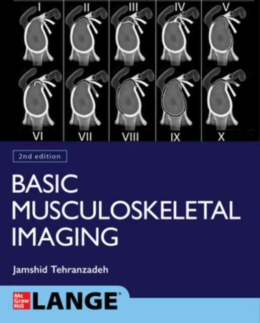 Book cover of: Basic Musculoskeletal Imaging, Second Edition. By: Jamshid Tehranzadeh