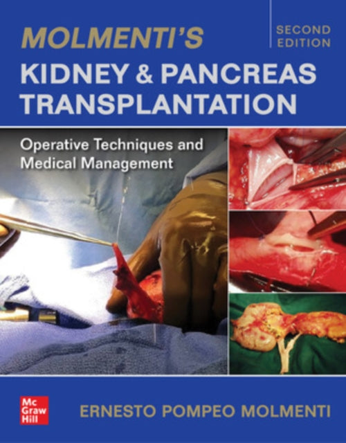 Book cover of: Molmenti's Kidney and Pancreas Transplantation: Operative Techniques and Medical Management. By: Ernesto P. Molmenti