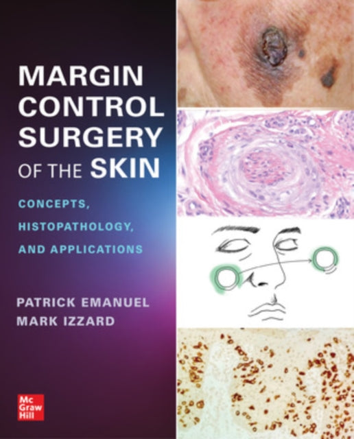 Book cover of: Margin Control Surgery of the Skin: Concepts, Histopathology, and Applications. By: Patrick Emanuel