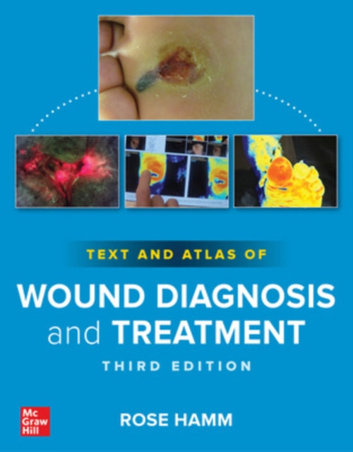 Book cover of: Text and Atlas of Wound Diagnosis and Treatment, Third Edition. By: Rose Hamm