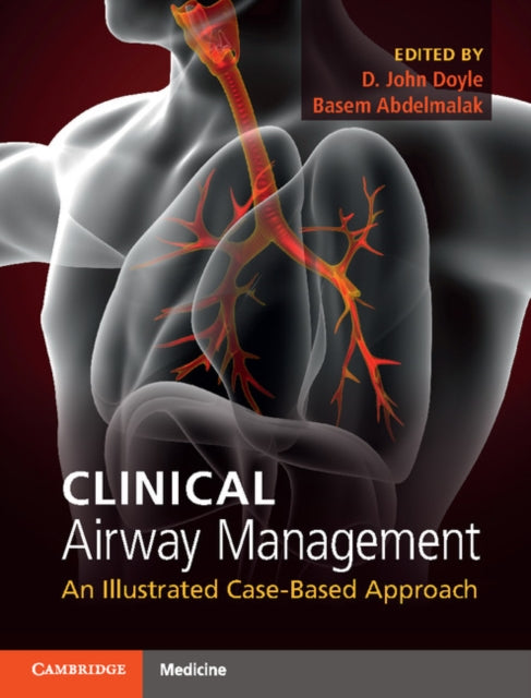 Book cover of: Clinical Airway Management. By: D. John Doyle
