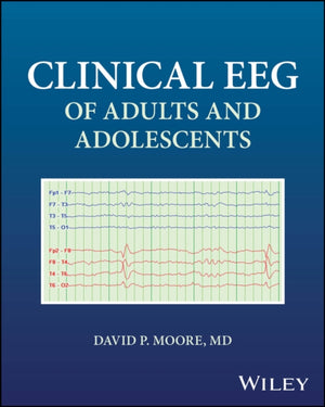 Clinical EEG of Adults and Adolescents