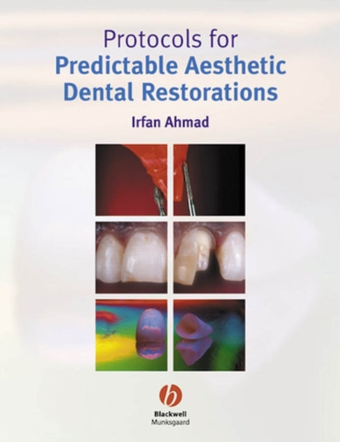 Book cover of: Protocols for Predictable Aesthetic Dental Restorations. By: Ahmad, Irfan BDS.