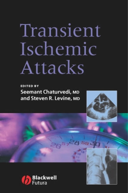 Book cover of: Transient Ischemic Attacks. By: Steven Levine