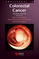 Book cover of: Challenges in Colorectal Cancer. By: Herand Abcarian