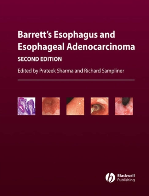 Book cover of: Barrett's Esophagus and Esophageal Adenocarcinoma