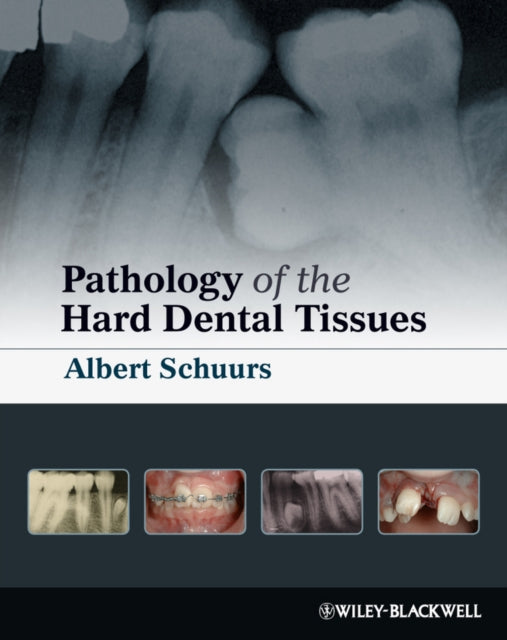 Book cover of: Pathology of the Hard Dental Tissues. By: A. H. B. Schuurs